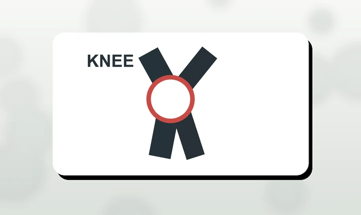 Illustration of a highlighted runner knee injury