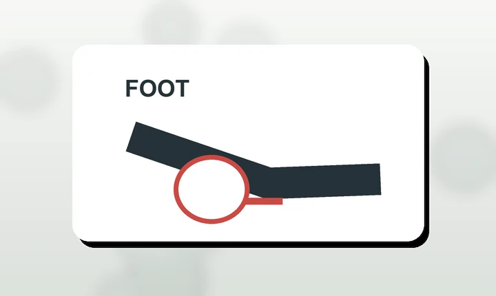 Illustration of highlighted plantar fascia foot pain